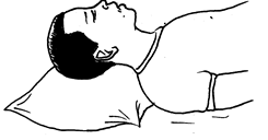 <em>The right position to offer first aid to a nose bleeding victim</em><strong></strong>